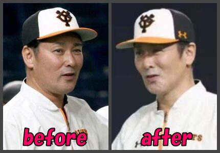 元木大介ビフォーアフター