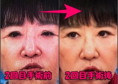 和田アキ子2回目