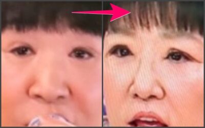 和田アキ子目比較