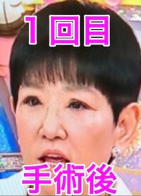 和田アキ子目1回目