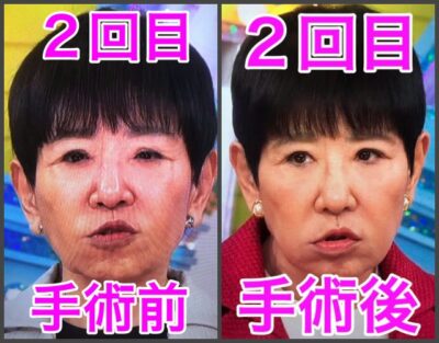 和田アキ子目元比較