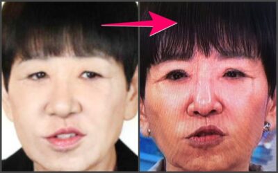 和田アキ子目変わった