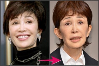 うつみ宮土理比較今昔