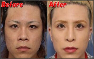 ローランド整形比較